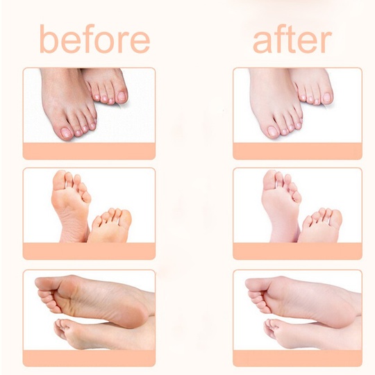 Смягчающая тканевая маска-носочки для ног с экстрактом меда Foot Mask